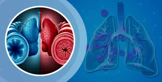 Asthma & COPD