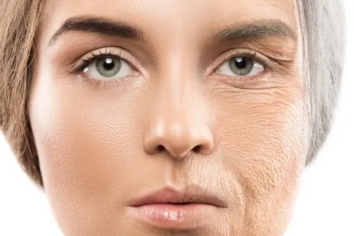 Skin Tightening Products Market